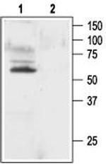 KV1.1 (KCNA1) Polyclonal Antibody
