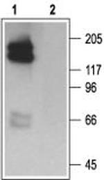 KCNH2 (erg1) Polyclonal Antibody