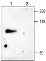 KCNC4 (KV3.4) Polyclonal Antibody