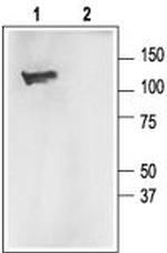 KCNMA1 (KCa1.1) (1097-1196) Polyclonal Antibody