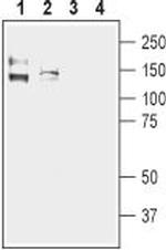 KCNMA1 (KCa1.1) (1097-1196) Polyclonal Antibody