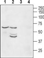Kir2.1/KCNJ2 Polyclonal Antibody