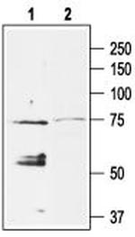 KCNJ5 (Kir3.4) Polyclonal Antibody