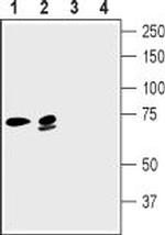KCNN2 (KCa2.2, SK2) Polyclonal Antibody