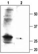 slo beta 1 (KCNMB1) Antibody in Western Blot (WB)