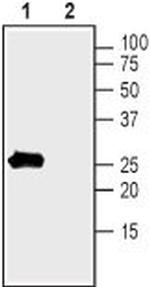 slo beta 1 (KCNMB1) Antibody in Western Blot (WB)
