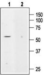 KCNK5 (TASK-2) Antibody in Western Blot (WB)