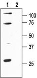 KCNN1 (KCa2.1, SK1) Antibody in Western Blot (WB)