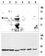 KCNK9 (TASK-3) (extracellular) Polyclonal Antibody