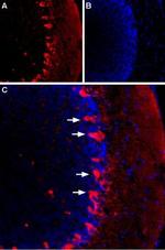 HCN1 Polyclonal Antibody