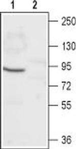 CNGA1 Polyclonal Antibody
