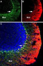 KV1.3 (KCNA3) (extracellular) Antibody in Multiplex Immunohistochemistry (mIHC)