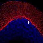 KV1.3 (KCNA3) (extracellular) Polyclonal Antibody