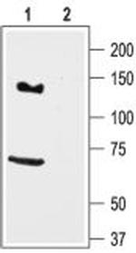 KCNH7 (erg3) Antibody in Western Blot (WB)