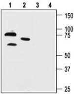 KV4.1 (KCND1) Polyclonal Antibody