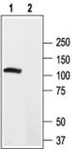 KV2.2 (KCNB2) Polyclonal Antibody