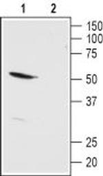 KCNK13 (THIK-1) (extracellular) Antibody in Western Blot (WB)