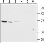 Kir7.1 (extracellular) Antibody in Western Blot (WB)