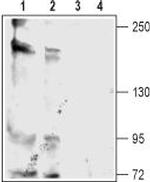 KCNT2 (Slick) Polyclonal Antibody