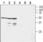 KV beta 1 Polyclonal Antibody