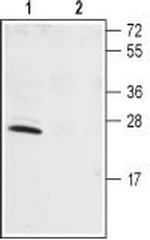 KChIP1 (KCNIP1) Polyclonal Antibody