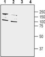 DPP10 (extracellular) Antibody in Western Blot (WB)