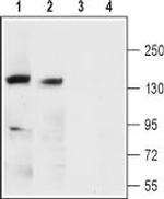 KCNMA1 (KCa1.1) (extracellular) Polyclonal Antibody
