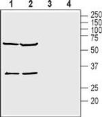 KCNK15 (TASK-5) (extracellular) Polyclonal Antibody