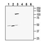 TMEM175 Antibody in Western Blot (WB)