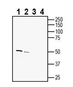 TMEM175 Antibody in Western Blot (WB)