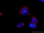 CD107a/LAMP1 Antibody in Immunocytochemistry (ICC/IF)