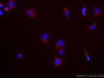 CD107b/LAMP2 Antibody in Immunocytochemistry (ICC/IF)