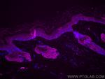 TACSTD2/TROP2 Antibody in Immunohistochemistry (Paraffin) (IHC (P))