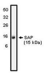 SH2D1A Polyclonal Antibody
