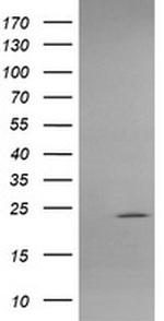 APCS Antibody in Western Blot (WB)