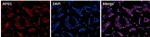 ATG5 Polyclonal Antibody