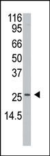 APH1 Antibody in Western Blot (WB)