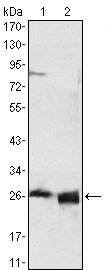ApoA1 Monoclonal Antibody (5F4F5)
