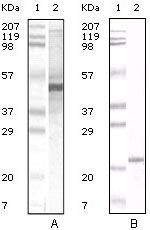 Apolipoprotein A5 Monoclonal Antibody (2G1H11, 1F1E8)