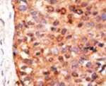 APOBEC3G Antibody in Immunohistochemistry (IHC)