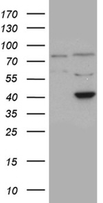 APOBEC4 Antibody in Western Blot (WB)