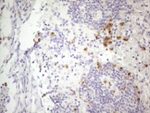 APOBR Antibody in Immunohistochemistry (Paraffin) (IHC (P))