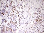 APOBR Antibody in Immunohistochemistry (Paraffin) (IHC (P))