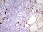 APOBR Antibody in Immunohistochemistry (Paraffin) (IHC (P))