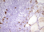 APOBR Antibody in Immunohistochemistry (Paraffin) (IHC (P))