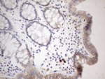 APOBR Antibody in Immunohistochemistry (Paraffin) (IHC (P))
