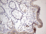 APOBR Antibody in Immunohistochemistry (Paraffin) (IHC (P))