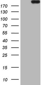APOBR Antibody in Western Blot (WB)