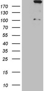 APOBR Antibody in Western Blot (WB)
