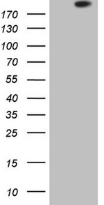APOBR Antibody in Western Blot (WB)